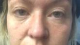 Moville woman Natasha Crumlish has lashed out at the Health Service
